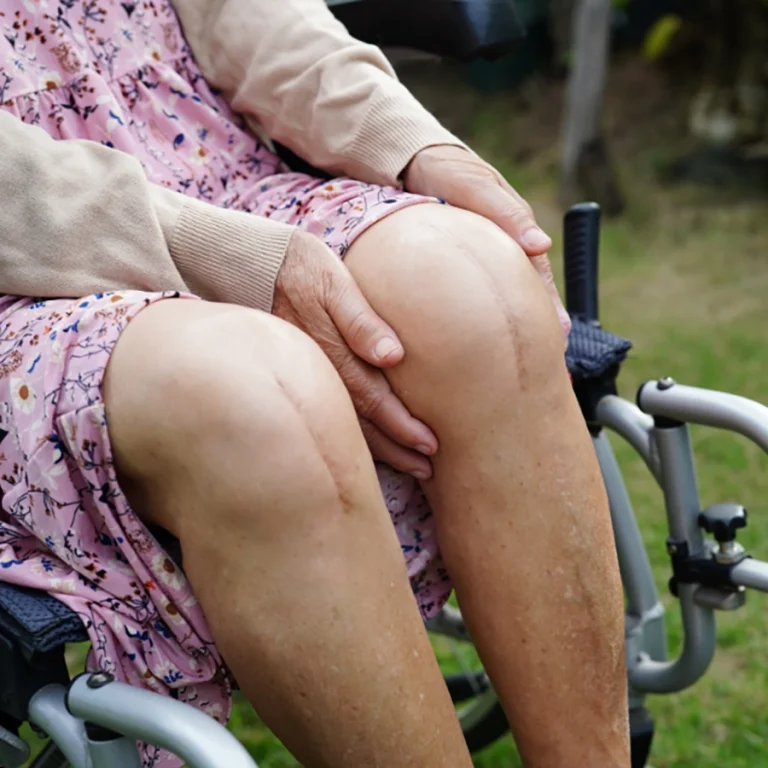 Knee replacement surgery recovery program in Melbourne